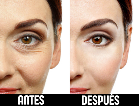 SkinFlex - Parches de Colágeno